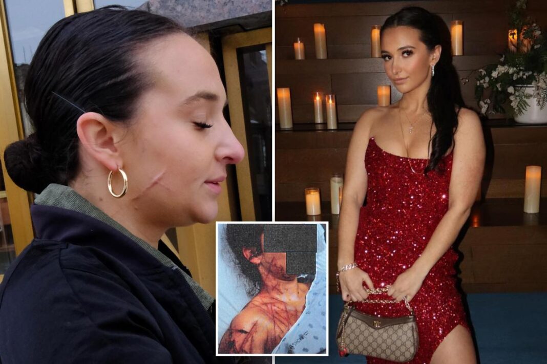 Ex-NJ GOP aide still carries visible scars after she paid fetish artist to carve her up